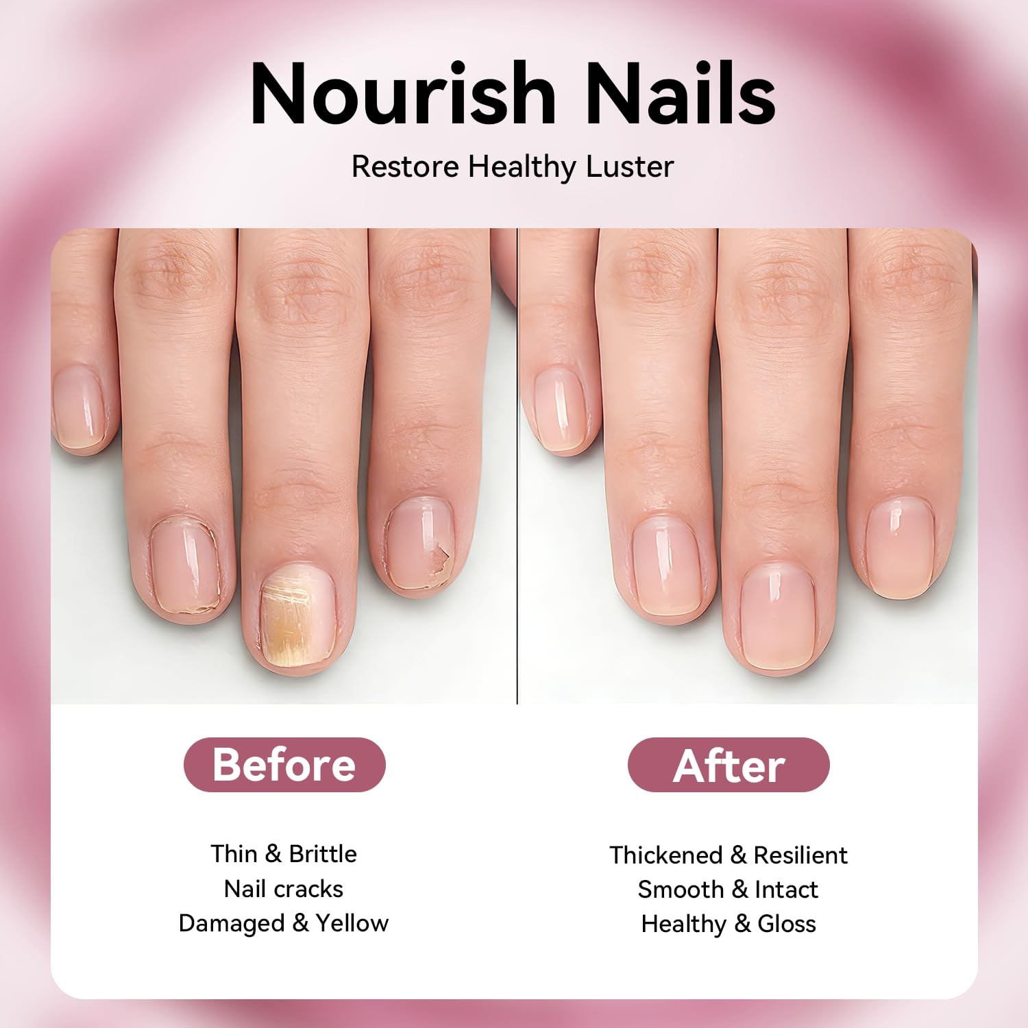 JODSONE Cuticle Oil for Damaged Skin And Thin Nails for Nail Growth Nourish and Condition Dry Nails with Dropper(White) - view 2